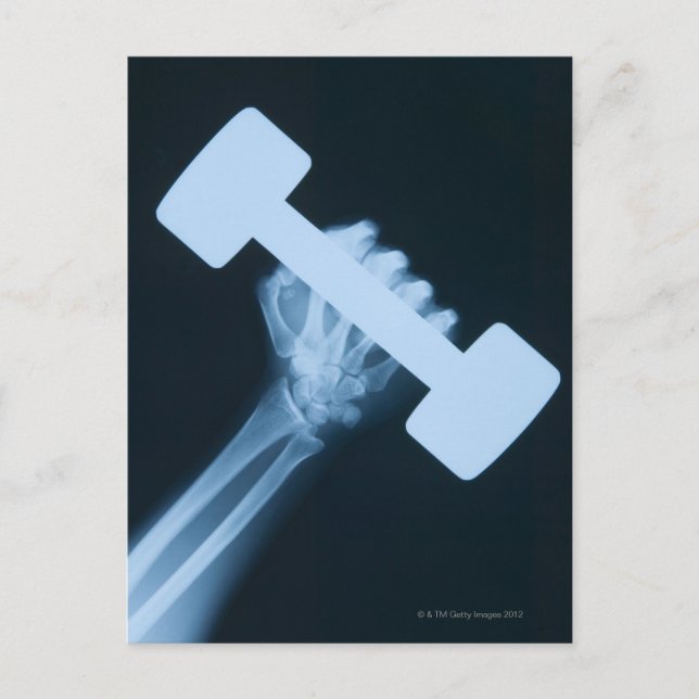 Röntgenbild av människan med vikt och närhet vykort (Framsida)