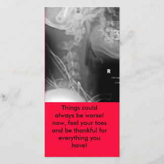 röntgenstrålen saker kunde alltid vara värre! nu tack kort