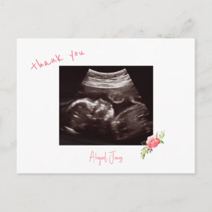 Rosa Baby Shower Ultrasound Cute Font Tack Vykort