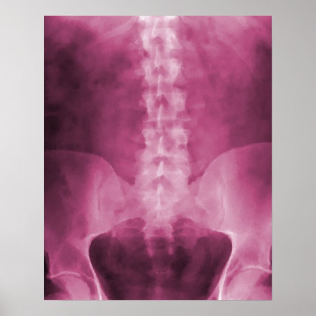 Rosa Digital X-Ray Art-utskrift Poster (Framsidan)