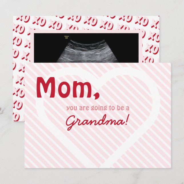 Rosa Grandma Valentine Ultrasound Gravid Reveal Meddelande (Fram/baksida)