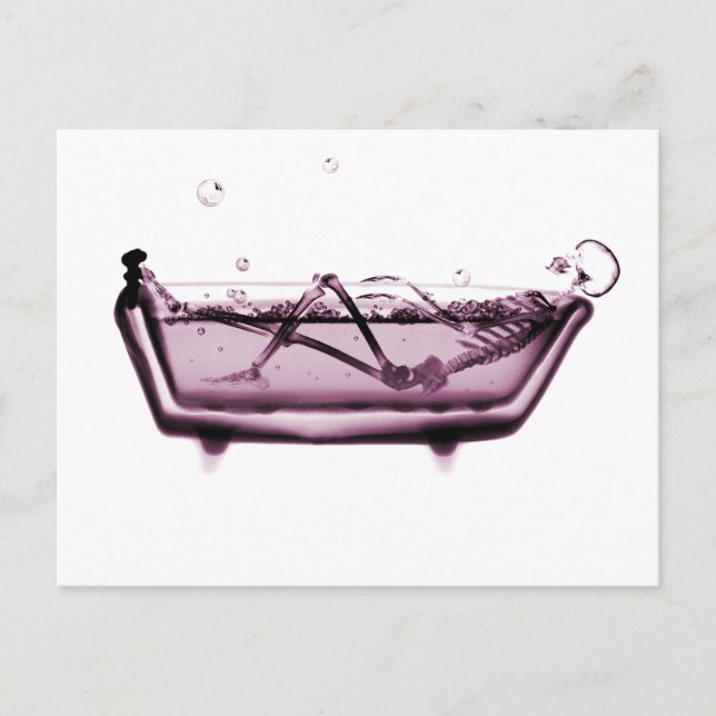 Rosa X-Ray Skeleton i Bath Tub Vykort (Framsida)