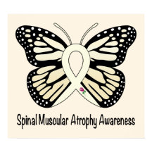 Ryggmuskelatrofi, hoppets fjäril