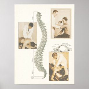 Ryggrads- justeringsaffisch för Chiropractic Poster