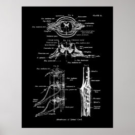 Ryggsladd Anatomi Medicinsk Poster