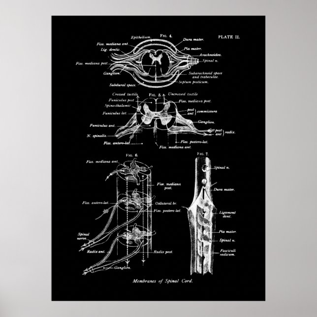 Ryggsladd Anatomi Medicinsk Poster (Framsidan)