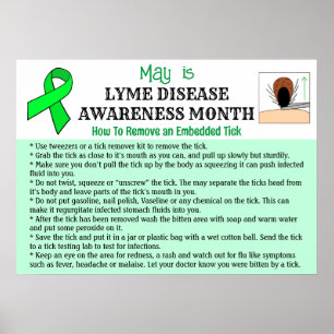 Så här tar du bort en fästutbildning poster