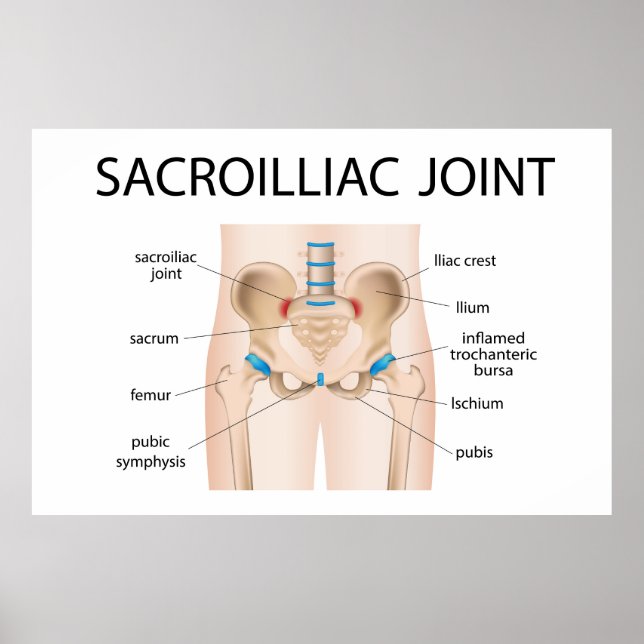 Sacroilliac joint poster (Framsidan)