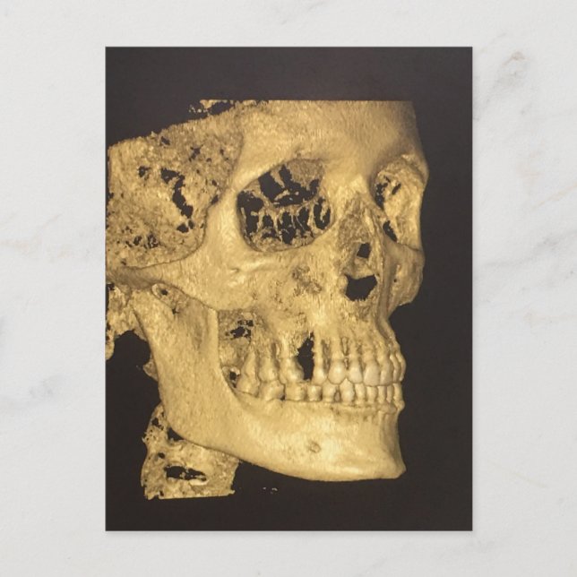 Scary Skull Vykort (Framsida)