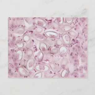 Science Parasite Vykort