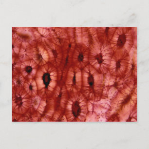 Sclerenchyma Cells från en Cherry Pit Vykort