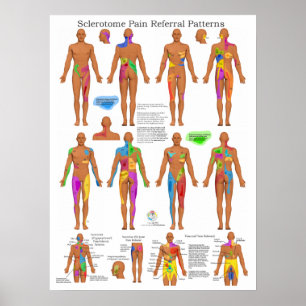 Sclerotome Joint Pain Referral Poster kiropraktik