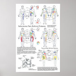 Sclerotome Visceral Pain Referral Diagram Poster