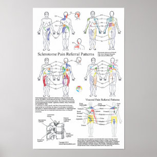 Sclerotome Visceral Pain Referral Diagram Poster
