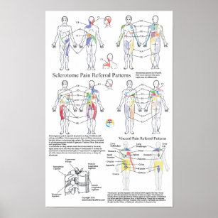 Sclerotome Visceral Pain Referral Diagram Poster