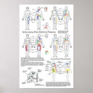 Sclerotome Visceral Pain Referral Diagram Poster