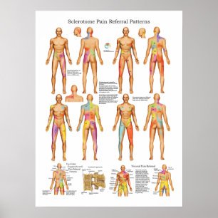 Sclerotome Visceral Pain Referral Poster