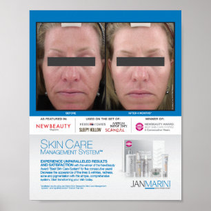 SCMS-resultat 8 x 10 tum Poster