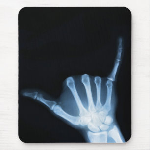 Shaka Sign X-Ray (Hopp Loose) Musmatta