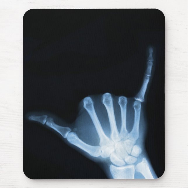 Shaka Sign X-Ray (Hopp Loose) Musmatta (Framsidan)