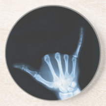 Shaka Sign X-Ray (Hopp Loose)