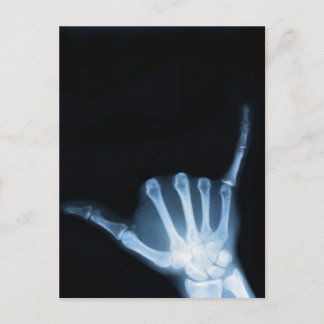 Shaka Sign X-Ray (Hopp Loose) Vykort