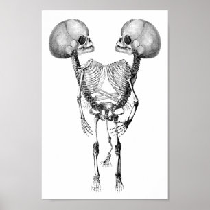 Siamesisk konförening av Twillingar Anatomy Skelet Poster