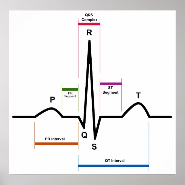 Sinusrytm i EKG- diagram med elektrokardiogram Poster (Framsidan)