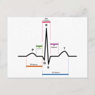 Sinusrytm i EKG- diagram med elektrokardiogram Vykort