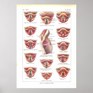 Sjukdomar av fransk för struphuvudanatomiaffisch poster