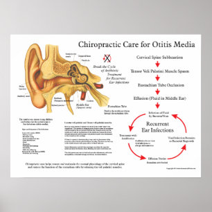 Sjukdomskänsla i ögat på Otitis Media Infektioner Poster
