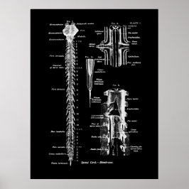 Sjukdomsskada på ryggradens anatomi poster