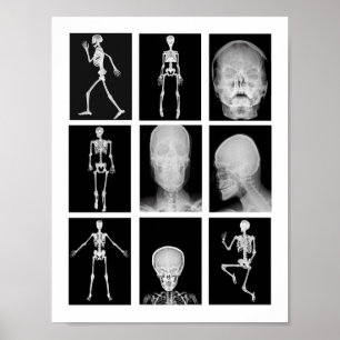 Skall - human kropp XRAYS Collage Art Poster