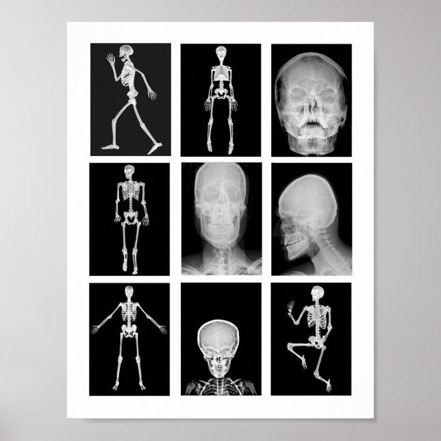 Skall - human kropp XRAYS Collage Art Poster (Framsidan)