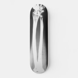 Skateboard Breaks av Bradley Boness