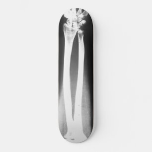 Skateboard Breaks av Bradley Boness