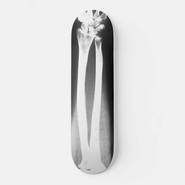 Skateboard Breaks av Bradley Boness (Framsida)