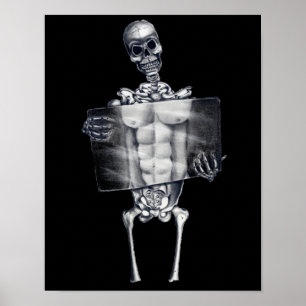 Skeleton Chest Xray Poster