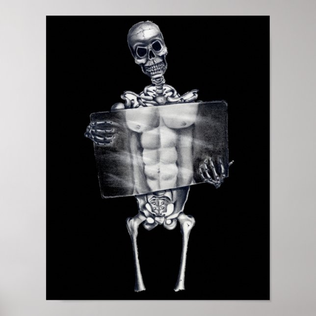 Skeleton Chest Xray Poster (Framsidan)