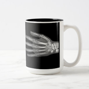 Skeleton Hand X-Ray Mugg