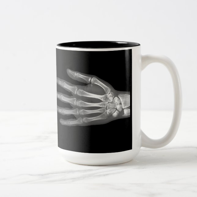 Skeleton Hand X-Ray Mugg (Höger)