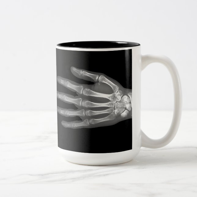 Skeleton Hand X-Ray Två-Tonad Mugg (Höger)