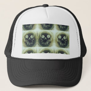 Skeleton Keps