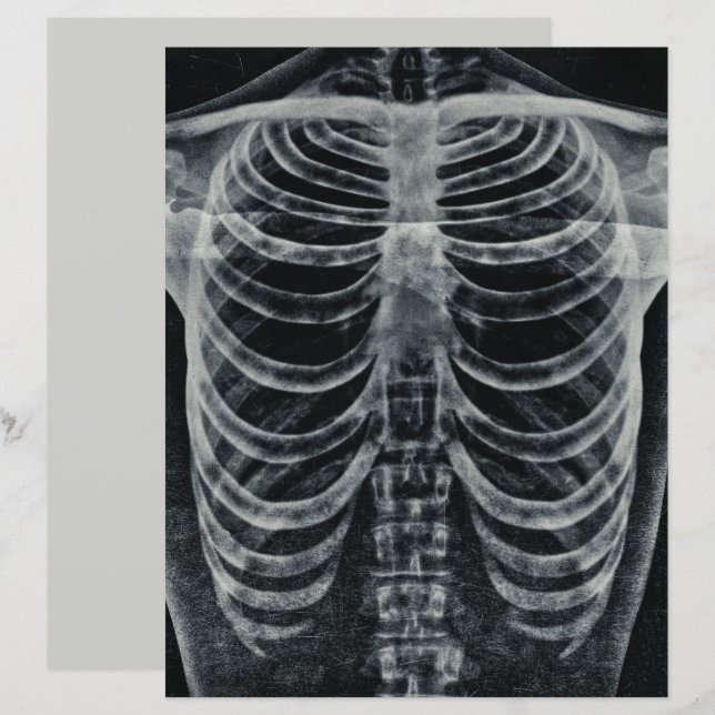 Skeleton Xray Rib Cage Vintage Black White Gothic (Fram/baksida)