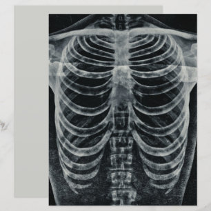 Skeleton Xray Rib Cage Vintage Black White Gothic