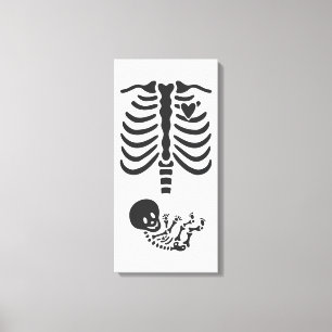 Skeletons Canvastryck