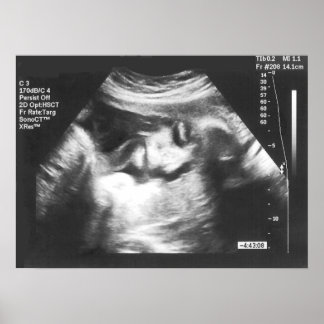Skojja Fake Ultrasound Bild Poster