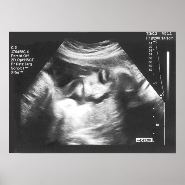 Skojja Fake Ultrasound Bild Poster (Framsidan)