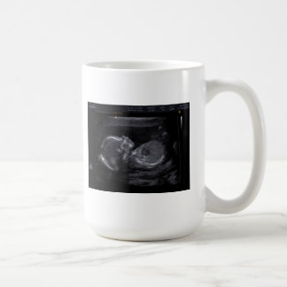 Skräddarsy Ultrasoundmugg Kaffemugg