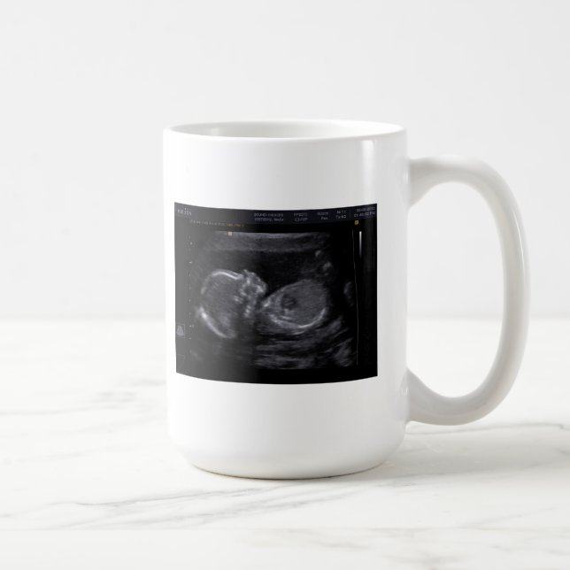 Skräddarsy Ultrasoundmugg Kaffemugg (Höger)